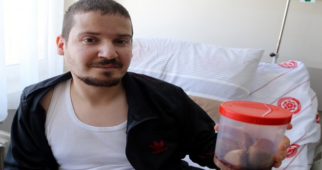 Mesanesinden 840 gr taş çıktı...