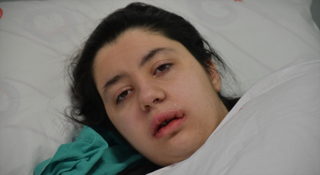 Sivas’ta 16 yaşındaki hasta, ilk kez gerçekleştirilen büyük çene ameliyatıyla sağlığına kavuştu