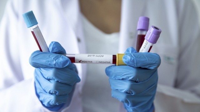 ”Koronavirüs’te tek çözüm tam kapanma”