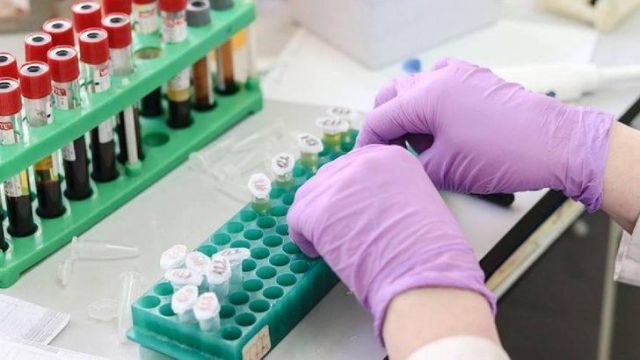 SMA Benimle Yürü Derneğinden SUT'ta yapılan değişiklikle ilgili açıklama: