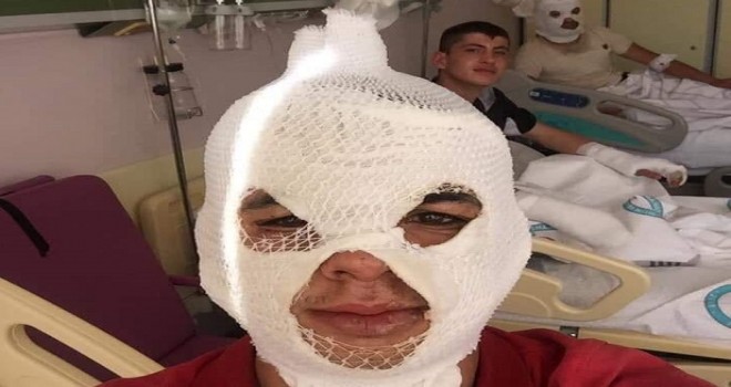 Seyir halindeki otomobil yandı...