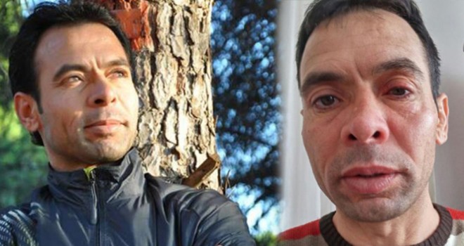 Antrenöre evinde asitli saldırı